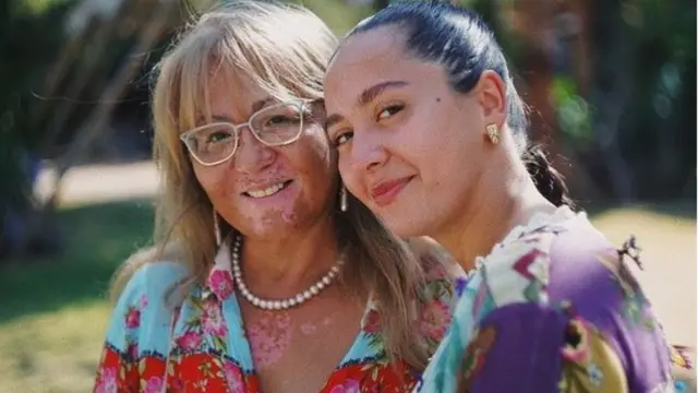 Manija və onun anası