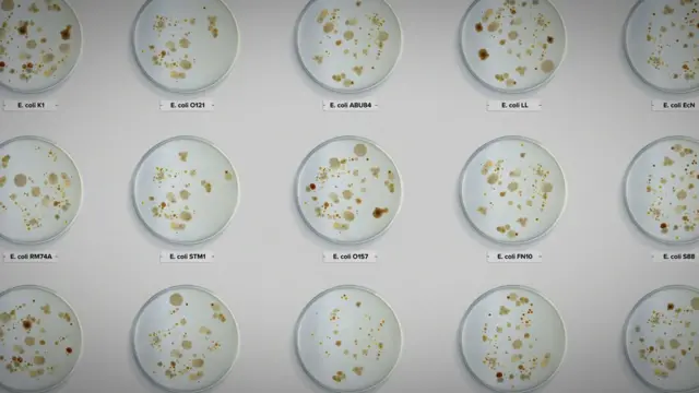 Dishes containing various types of E. coli bacteria