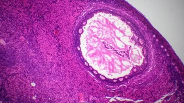 શુક્રાણુ