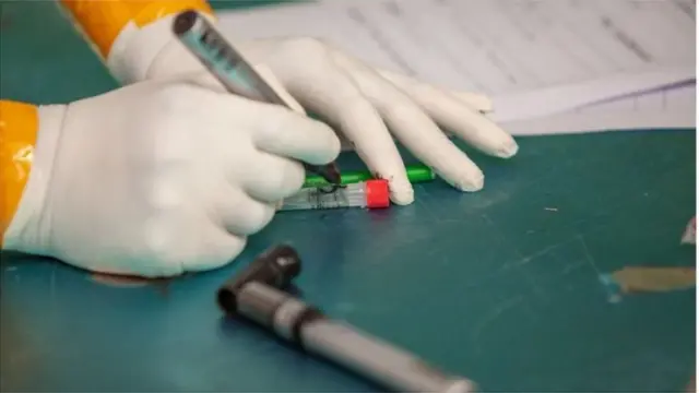 দ্বিতীয় দফা সংক্রমণ দ্রুত শনাক্তকরণে র‍্যাপিড টেস্ট কিটের অনুমোদন দেয়া হয়।