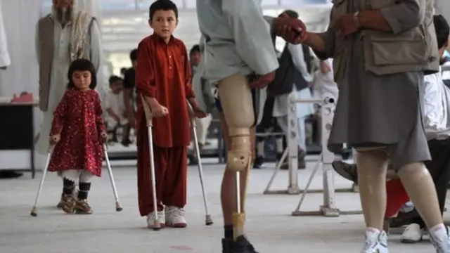 کانچ سے ہڈی کا علاج