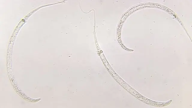 Nematoda sangat kecil tetap jumlahnya sangat besar.