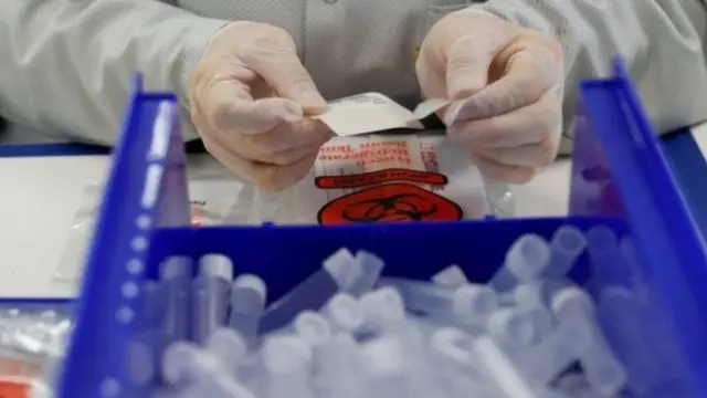 कोरोना वयारस टेस्ट