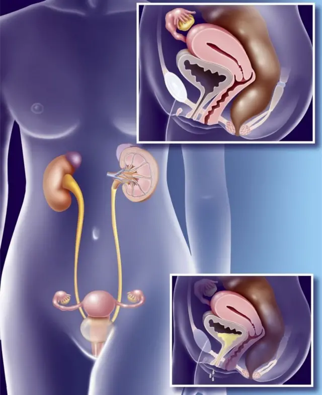 मूत्रविसर्जनाची यंत्रणा