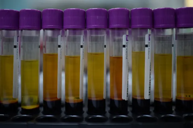 วันเอดส์โลก, โรคเอดส์, เอชไอวี, ยาต้านไวรัส, ผู้ติดเชื้อ