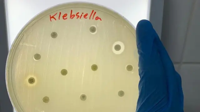 Mão com luva segura vidro sobre o qual se lê: Klebsiella