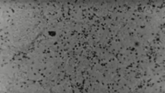 ภาพถ่ายเชื้อไวรัสโคโรนาสายพันธุ์ใหม่ 2019-nCoV ที่เพาะได้นอกประเทศจีนเป็นครั้งแรก