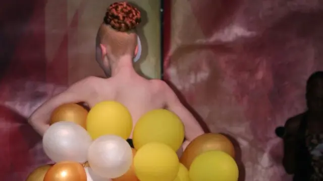 Louise Lihanda, ayaa ku guuleysatay tartanka quruxda Albino oo narkii ugu horreysay Kenya lagu qabtay