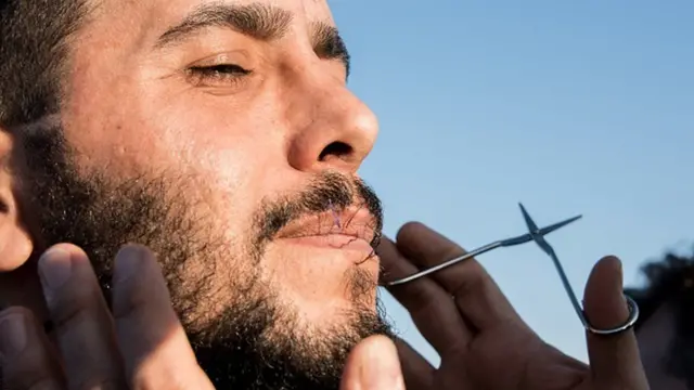 зашивання рота