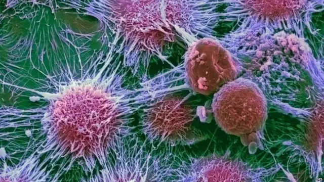 कॅन्सर सेल