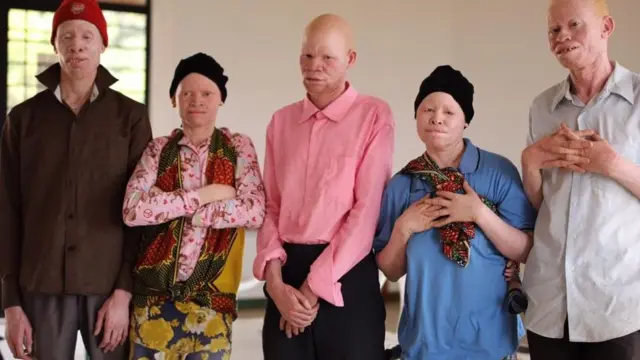 Tanzania Albinism Collective