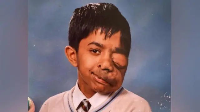 Dečak od 11 godina pre složene operacije oka 