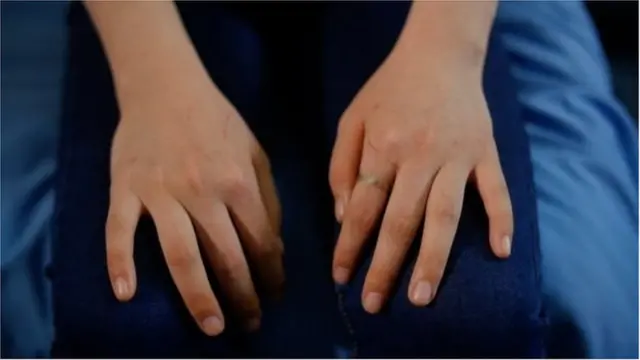 পাঁচঘণ্টা ধরে একটি পাহাড় বেয়ে ওঠার ছাপ পড়েছে জিউনের হাতে