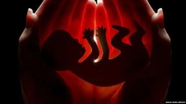 ਨਿਊਜ਼ੀਲੈਂਡ ਸਰਕਾਰ ਨੇ ਜੋੜੇ ਦੇ ਲਈ ਮਿਸਕੈਰੇਜ ਲੀਵ ਦਾ ਪ੍ਰਬੰਧ ਕੀਤਾ ਹੈ