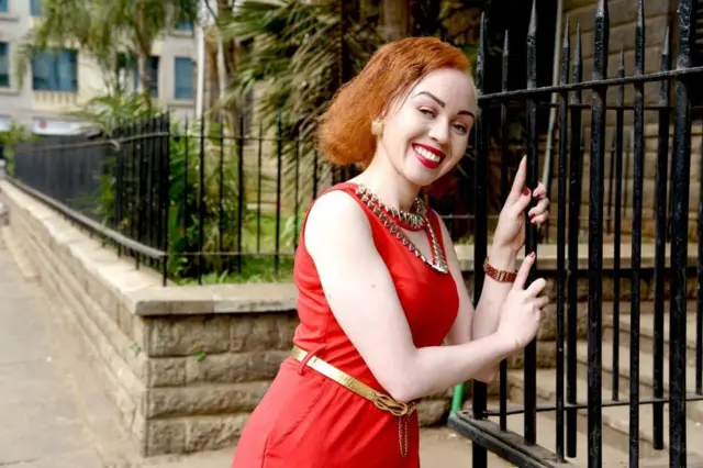 Maria Nzomo anayeishi na tatizo la ulemavu wa ngozi