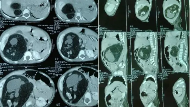 અલ્ટ્રાસાઉન્ડ