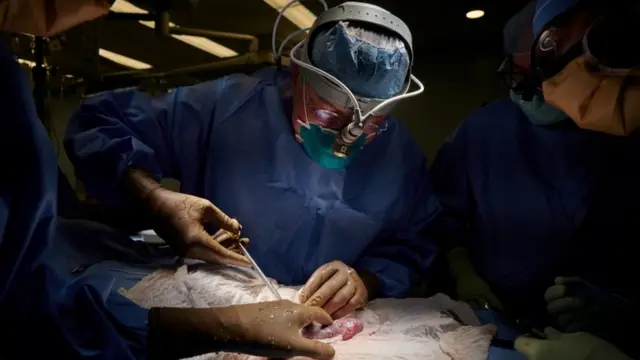 pig kidney transplant