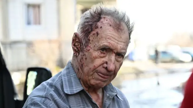 Cause of Russia and Ukraine war: First images of Ukraine under Russia attack