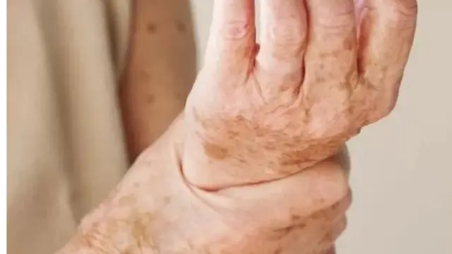 হাড় ক্ষয় রোগে বয়ষ্করাই বেশি আক্রান্ত হন।