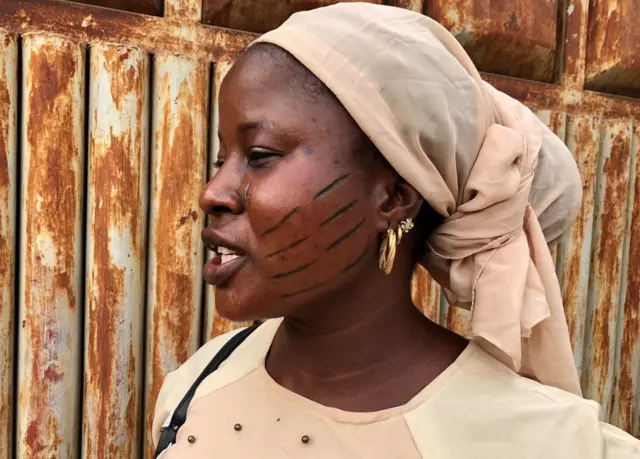 A woman with scars on her face
