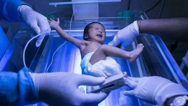 சுகப்பிரசவம் மற்றும் சிசேரியன்: குழந்தையின் பாக்டீரியா நிலையில் வித்தியாசம்