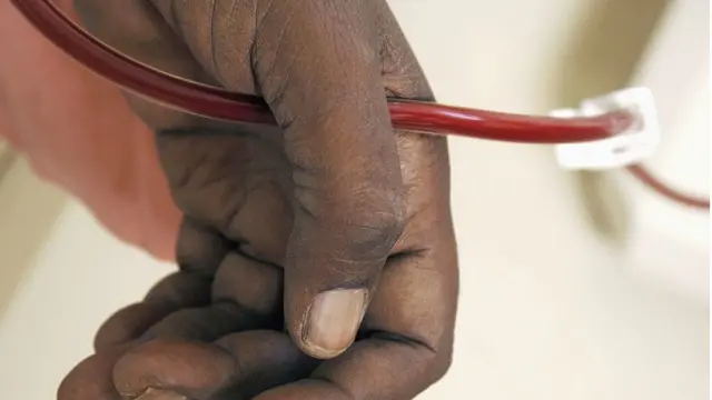 Pesin dey watch blood comot from am