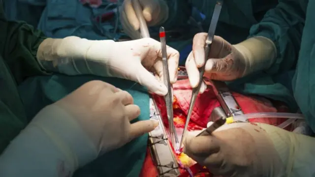 உறுப்பு மாற்று