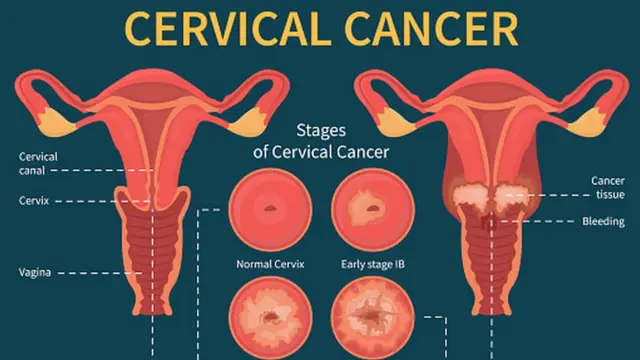 सांकेतिक तस्वीर