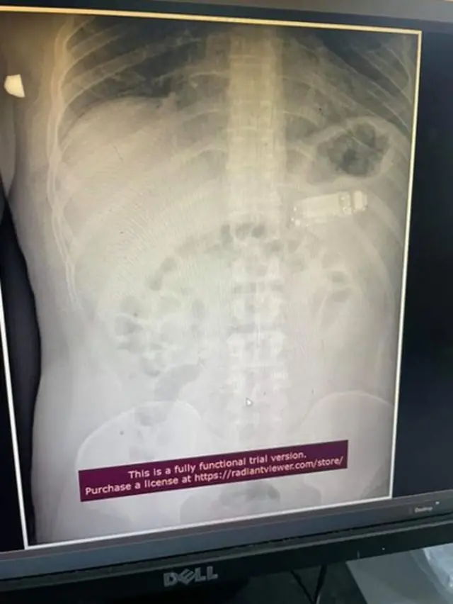 Rentgen snimak telefona