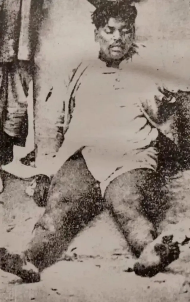 આઝાદના મૃત શરીરનું પોસ્ટમૉર્ટમ સિવિલ સર્જન લેફ્ટનન્ટ કર્નલ ટાઉનસેન્ડે કર્યું હતું