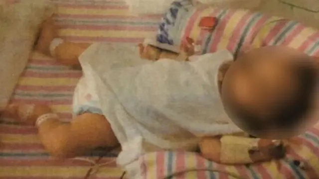 பாதிக்கப்பட்ட குழந்தை