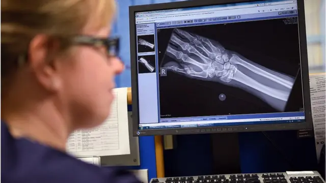 Röntgen yapılan bir el