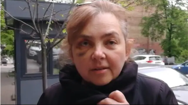 Олена, матір Анастасії, каже, що на неї з онуком напав колишній заять і ще група чоловіків