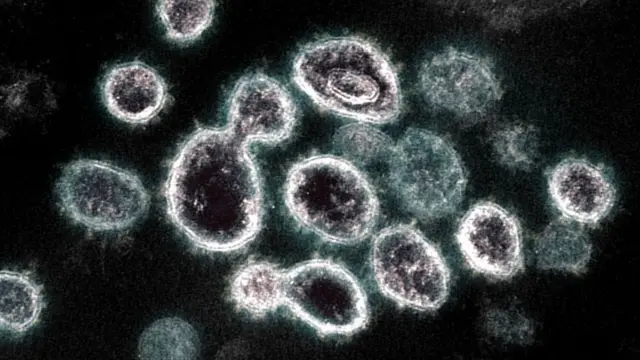 Cette image au microscope électronique à transmission montre le SARS-CoV-2, le virus responsable de la COVID-19, isolé d'un patient.