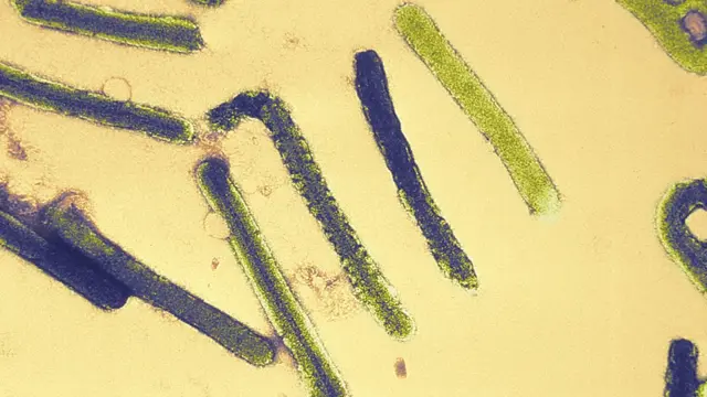 Cette micrographie électronique montre un certain nombre de souches du virus de Marbourg responsables de la fièvre hémorragique de Marbourg.