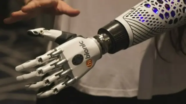 ఏంజెల్ గ్విఫ్రియా బయోనిక్ చేయి