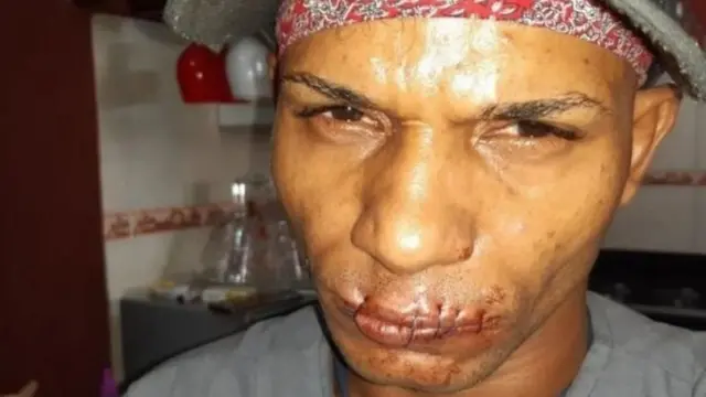 Wani dan kungiyar San Isidro masu sukar gwamnatin Cuba