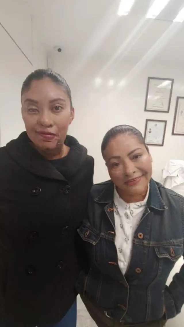 Esmeralda Millán y Carmen Sánchez.