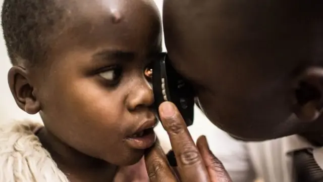 kubitaro vya Mbarara