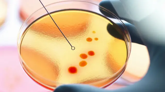 கொரோனா வைரஸ்