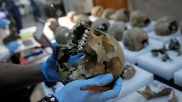 মাথার খুলি