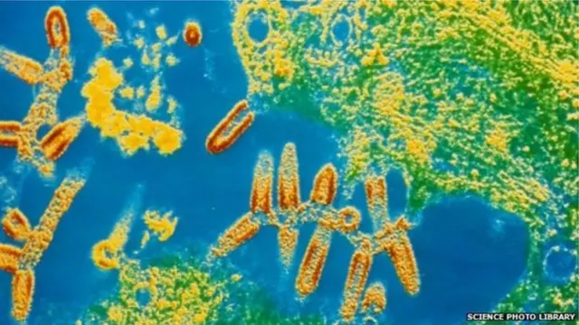 เชื้อไวรัสพิษสุนัขบ้า