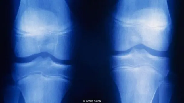 Microsoft-n anekonik kamerası o qədər səssizdir ki, hərəkət etdikcə öz sümüklərinin sürtünməsini eşidə bilərsən