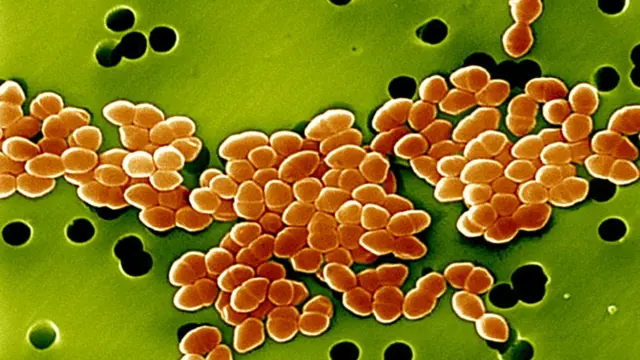 Bacteria
