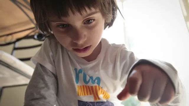 Niña con síndrome de Angelman.