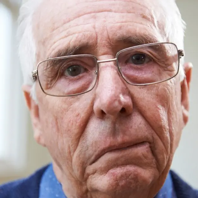 Homme avec une paralysie d'un côté du visage