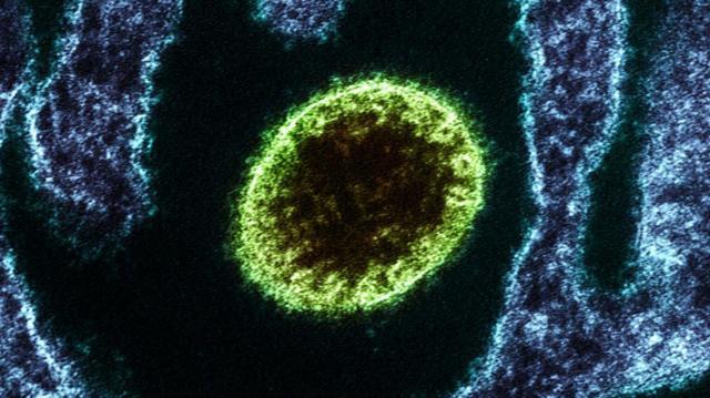 Virus Nipah (hijau) dilihat melalui mikroskop elektron.