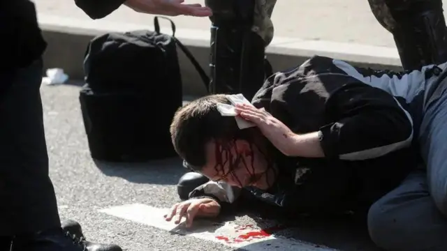 Povređeni demonstrant