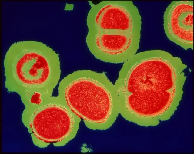 एमआरएसए