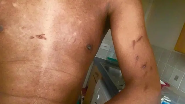 أحمد يقول إنه عذب خلال احتجازه